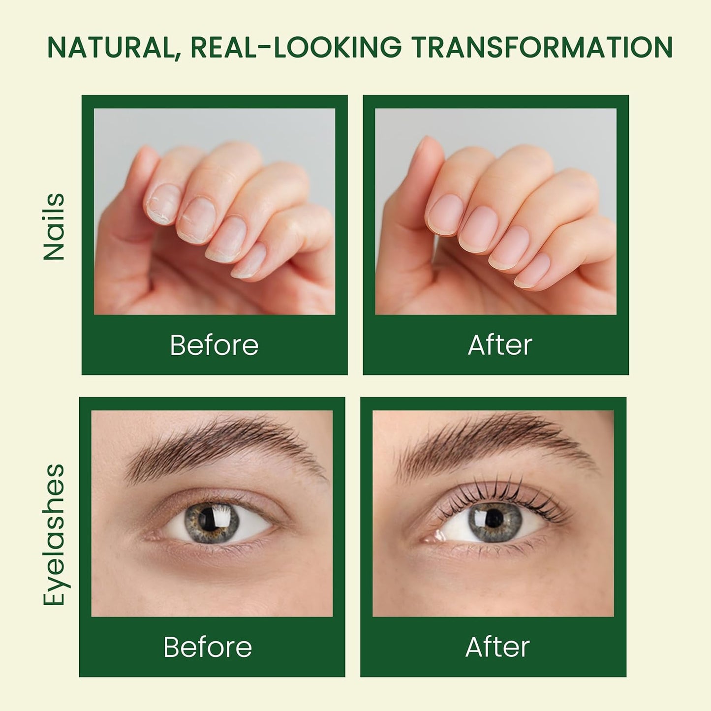 Pure Castor Oil - Cold Pressed 100% Natural Oil for Hair Growth, Skin & Nails | 10oz with Dual Mascara & Dropper