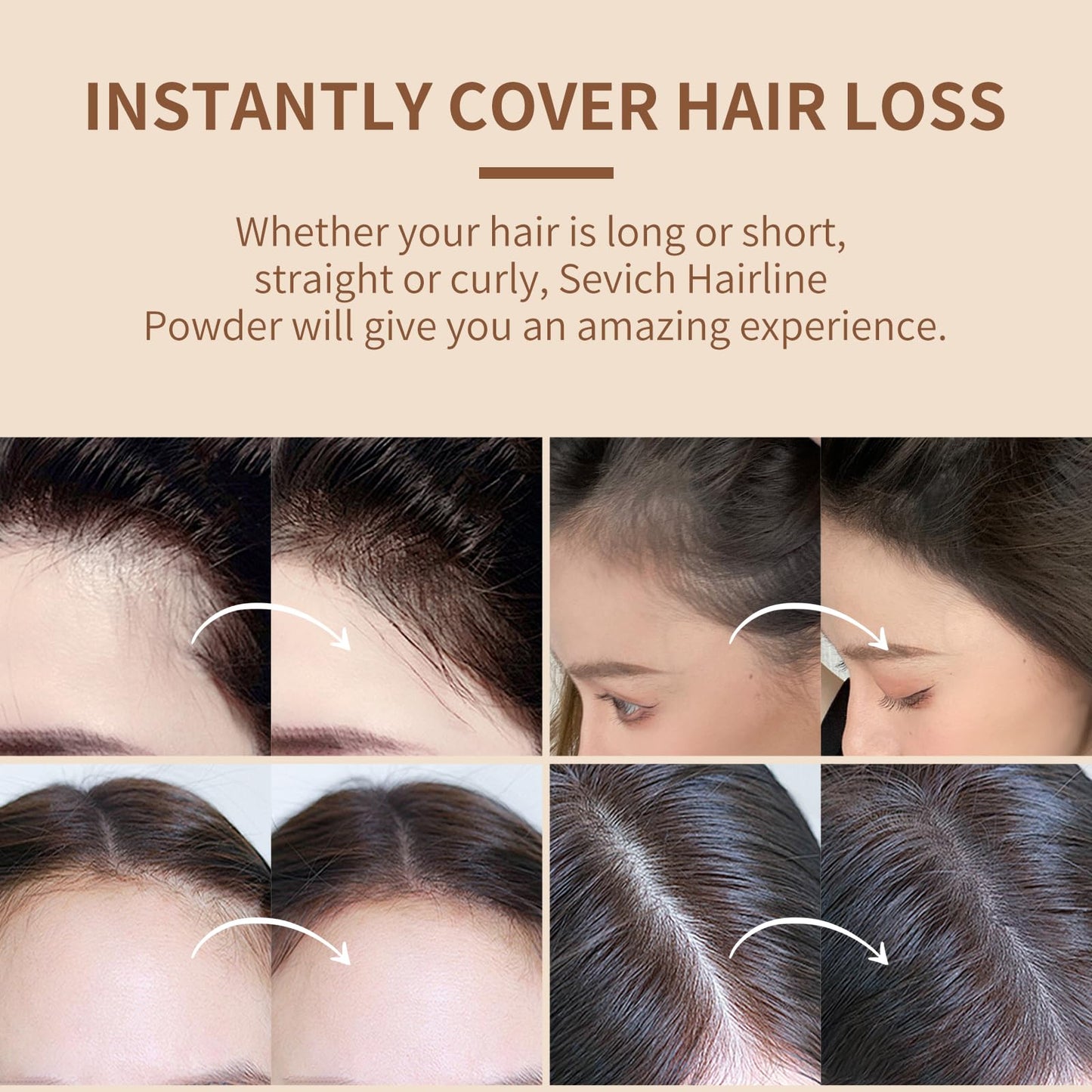 Sevich Hairline Powder,Instantly Conceals Hair Loss, Root Touch up Powder, Hair Shadow Toppers for Women & Men, Touch Up for Thinning Gray Hair, Windproof & Sweatproof,Black