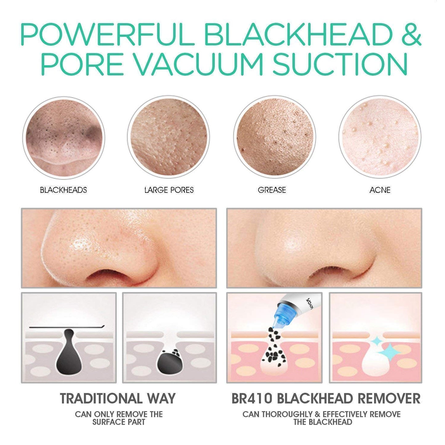Blackhead Remover Pore Vacuum - Rechargeable Facial Cleansing Brush for Deep Cleaning & Exfoliation