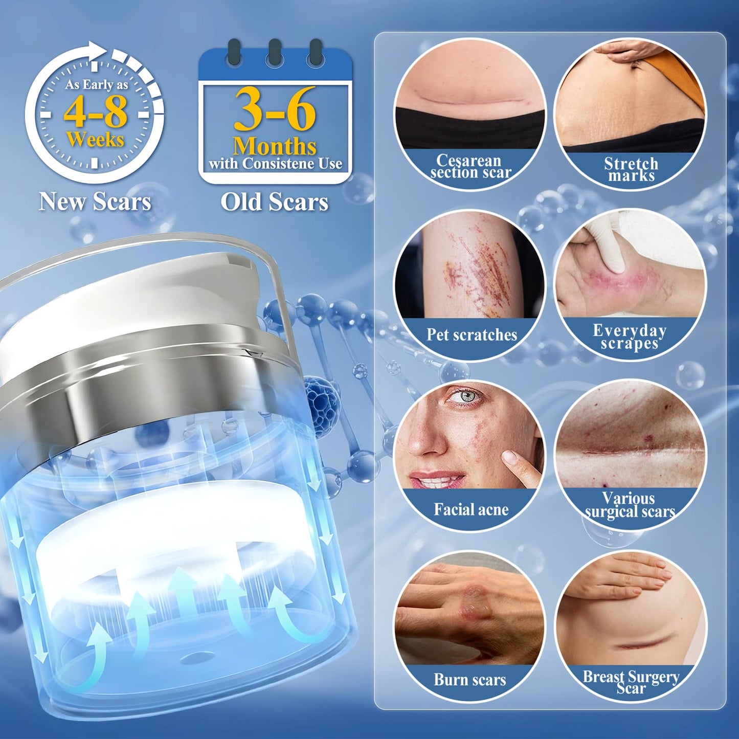 Arme Physician Formulated Patented 52% Silicone Scar Gel Scar Cream, Scar Removal Cream for Surgical Scars,Scar Treatment for Face,Body, Surgical, Burns, Keloid Acne,C Section,Stretch Marks,1.76oz/50g