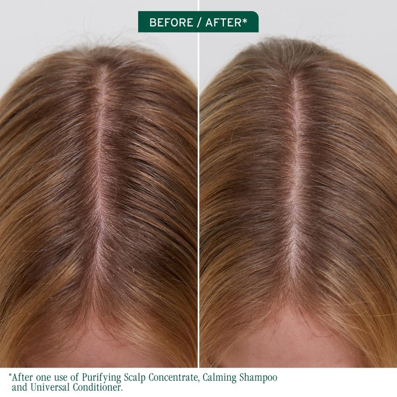 Biolage Scalp Sync Purifying Concentrate - For All Scalp Types, Exfoliating & Clarifying Treatment, Removes Buildup, Refreshing & Reinvigorating, Fermented Tea Blend & Glycolic Acid