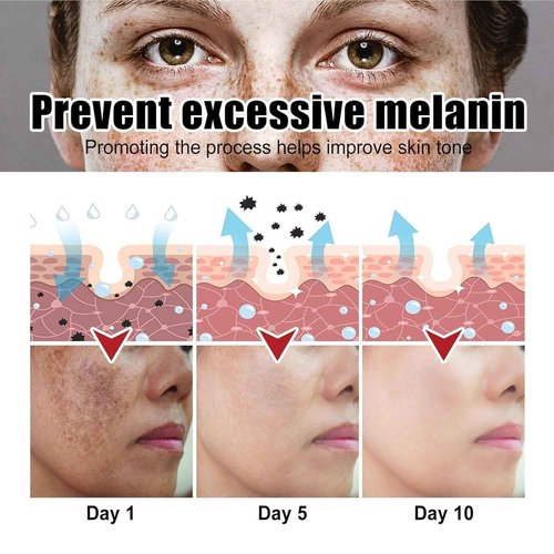 Crema para Manchas Oscuras en La Cara, Cremas para Quitar Manchas de La Cara, Crema para Las Manchas de La Cara, 50 ML / 1.7 FLOZ