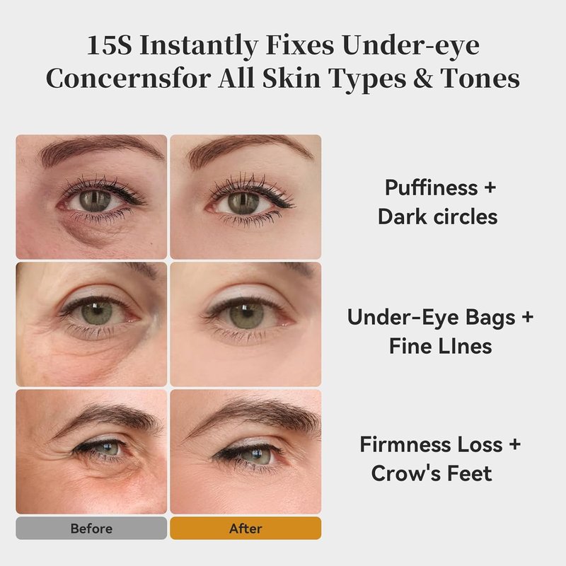 KOKN Instant Firmx Eye & Face Cream - Temporary Eye Tightener for Wrinkles, Puffiness & Bags | 0.71 Fl Oz