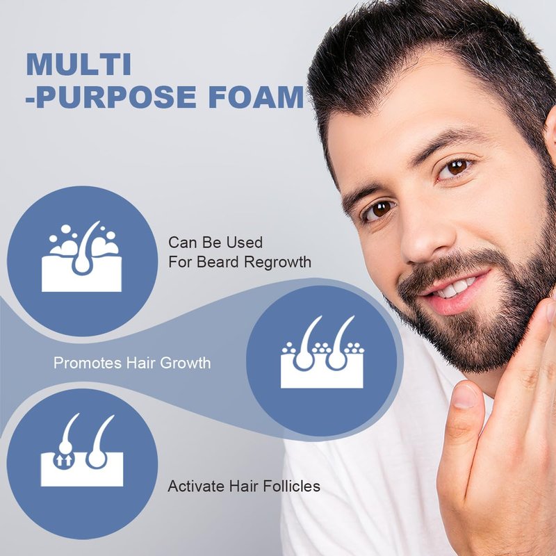 FluMisch 5% Minoxidil Foam for Men, 5% Biotin and 5% Minoxidil Use for Hair Growth, Slows Hair Loss and Promotes Hair Regrowth, 3 Month Supply (3Pcs)