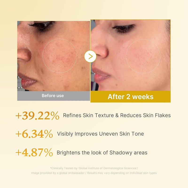 Kojic Acid Clarity Duo - Turmeric Clarifying Pad & Smoothing Toner for Troubled Skin | Face & Body Care