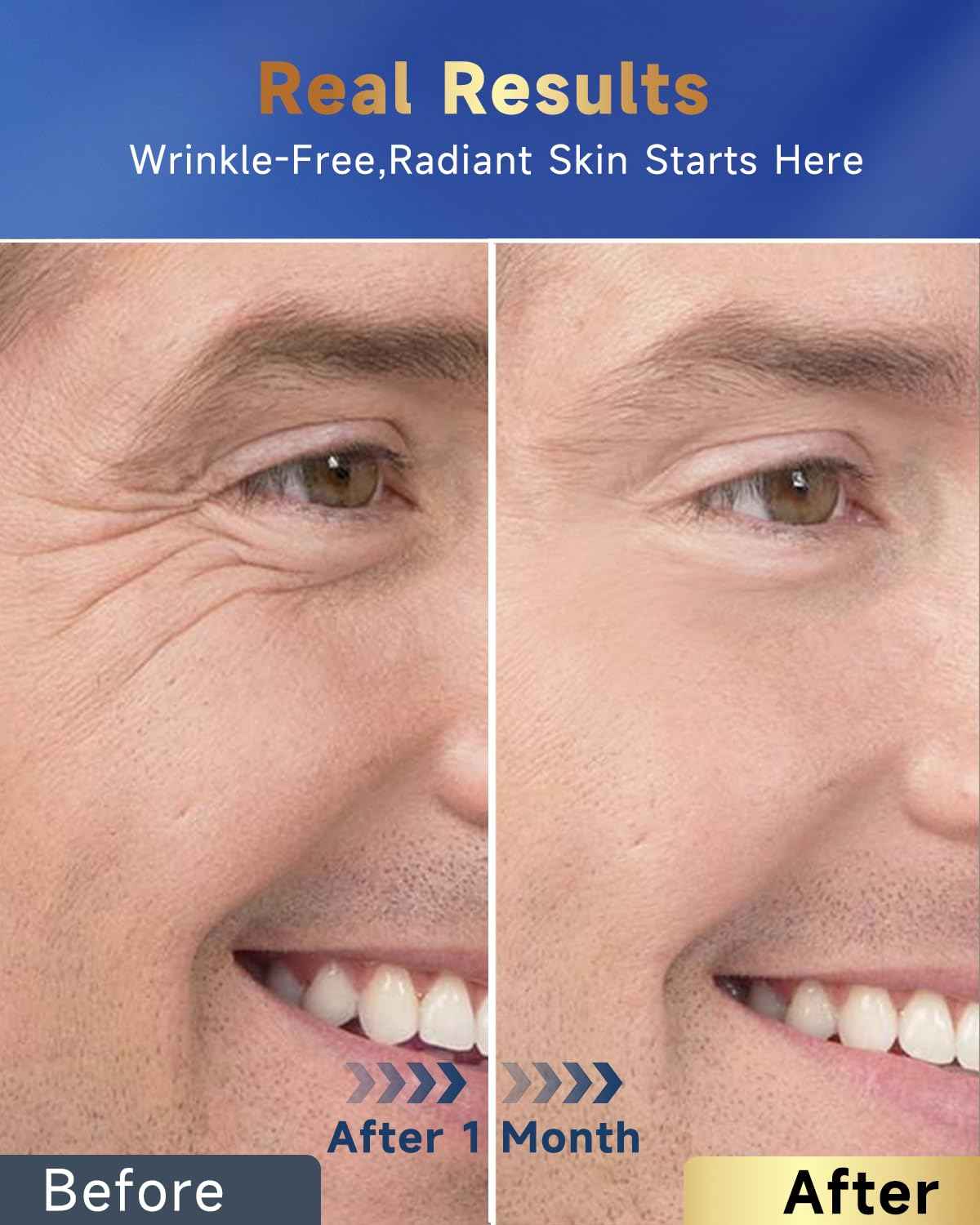 Felicemy 6-in-1 Face Cream for Men, Mens Face Moisturizer, Anti-Aging Face Cream for Men with Retinol Collagen & Hyaluronic Acid, Eye Bags & Dark Spot Remover, After Shave Lotion 1.7 Fl Oz