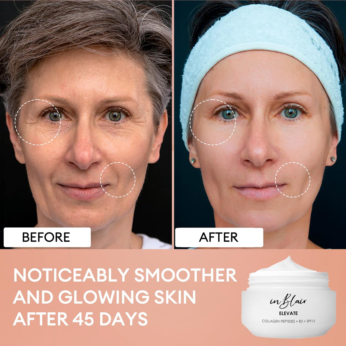 Inblair Elevate Moisturizing Cream for Face | Facial Care for Dry Skin with SPF | Hydrating Moisturizer Rich in Niacinamide, Hyaluronic Acid & Collagen Peptide | Anti Aging Day Cream