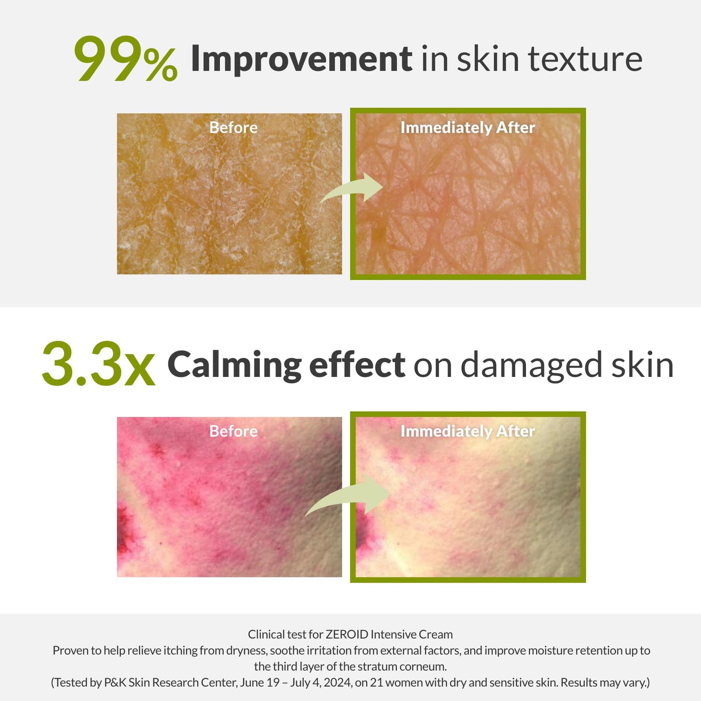 ZEROID | Intensive Cream | Face Moisturizer for Dry & Disordered Skin | Face Cream for Sensitive Skin | Face Lotion For Skin Barrier Repair | Korean Skincare | Korean Moisturizer | 2.7 fl oz (80ml)