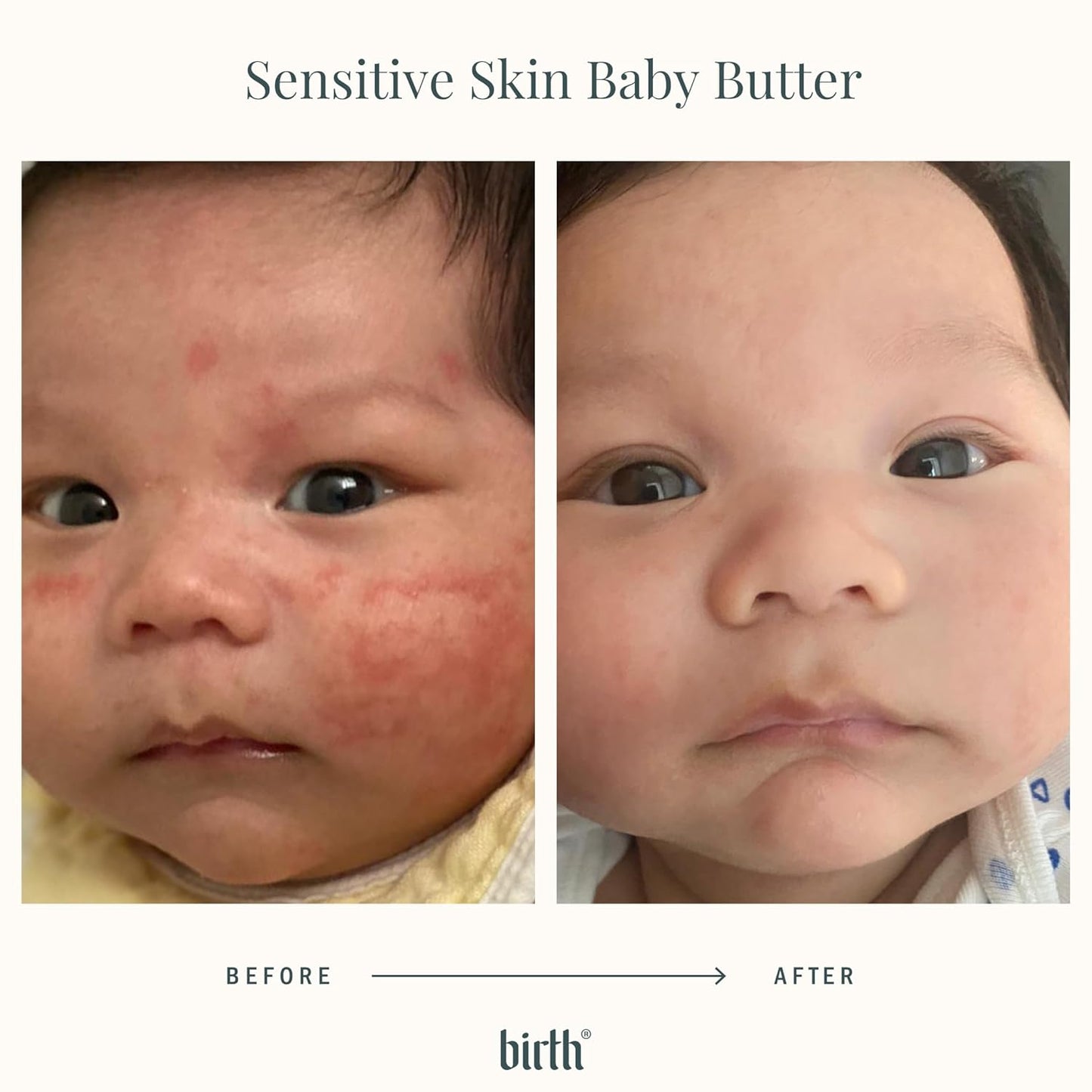 Baby Eczema Butter - Steroid-Free Natural Cocoa Seed Butter & Colloidal Oatmeal | Soothes Itchy Skin | Non-Greasy 4oz