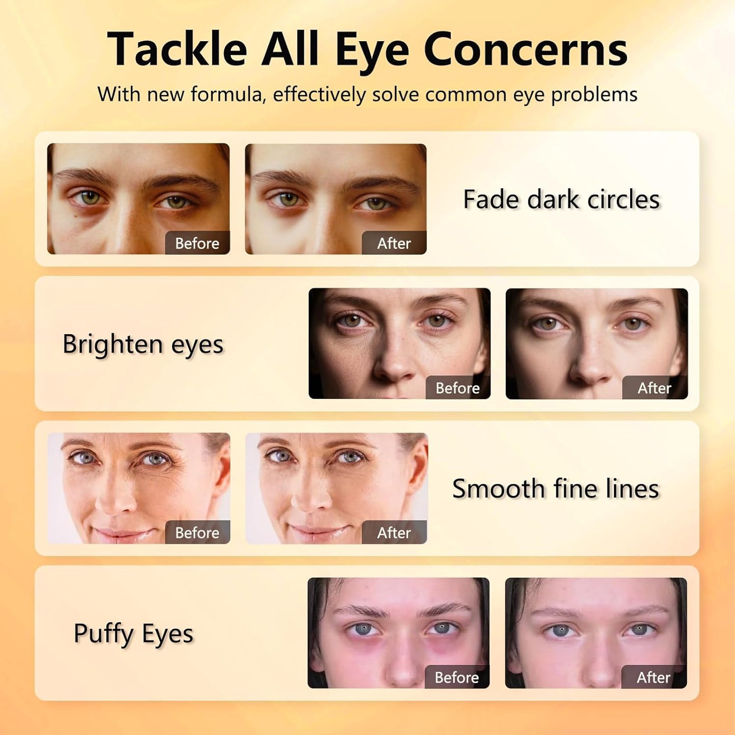 Under Eye Patches - Vitamin C & Caffeine Hydra-Gel for Dark Circles | 30 Pairs, Anti-Aging Care