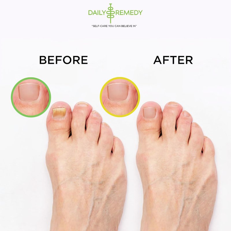 DAILY REMEDY EXTRA STRENGTH Tea Tree Oil & Citrus Detox Foot Soak Set - Made in USA - Soothes Sore Tired Feet, Athletes Foot, Stubborn Foot Odor, Softens Calluses & Refreshes & Detoxifies - Pack of 2