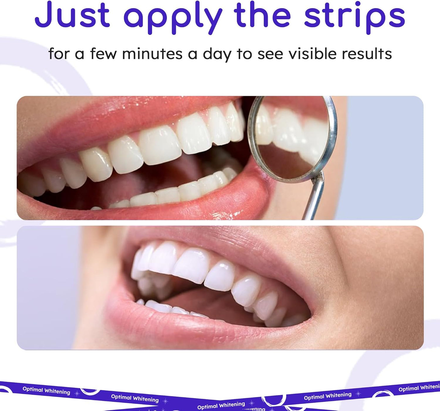 Teeth Whitening Strips for Sensitive Teeth - 14-Day Treatment Kit | Fast-Acting Stain Removal, Comfortable Fit