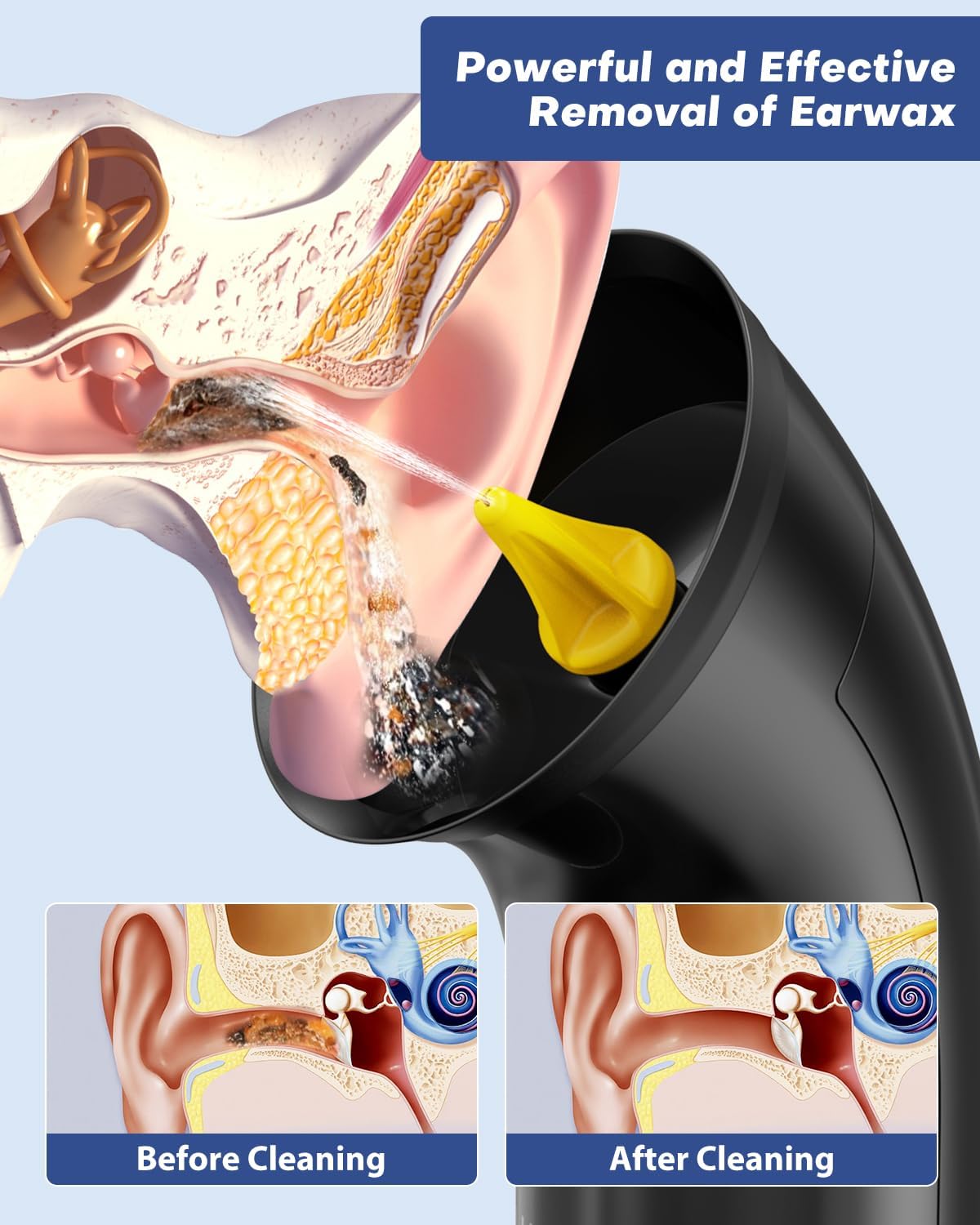 Ear Wax Removal Kit - 250ML Dual Water Tank, 4 Pressure Settings, Type-C Charging | Safe & Effective Cleaning