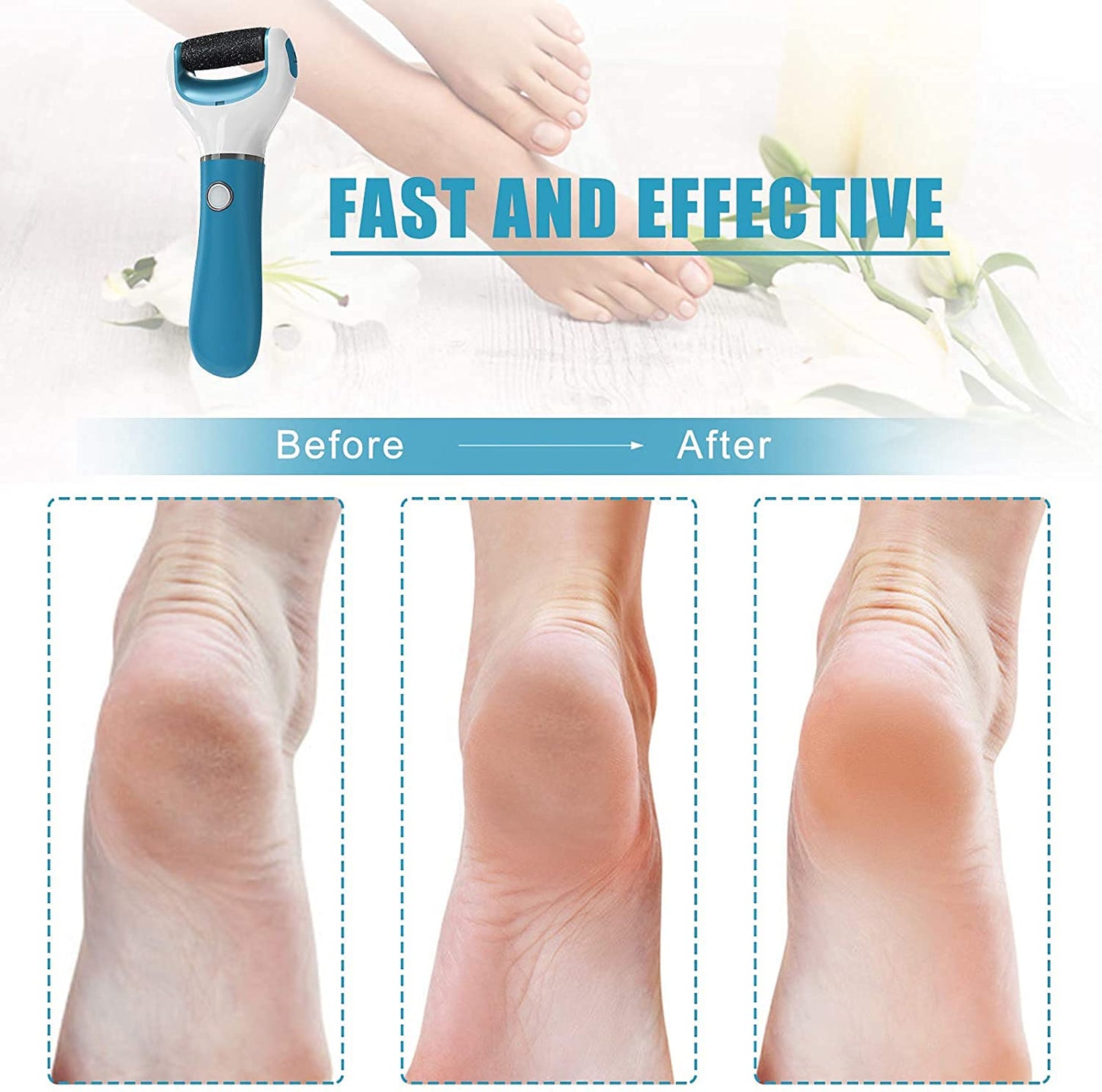 Electric Foot File Callus Remover Professional, 2-Speed Rechargeable Pedicure Tool for Remove Calluses, Dry, Hard, Dead, Cracked Skin, Includes 2 Coarses (Blue)