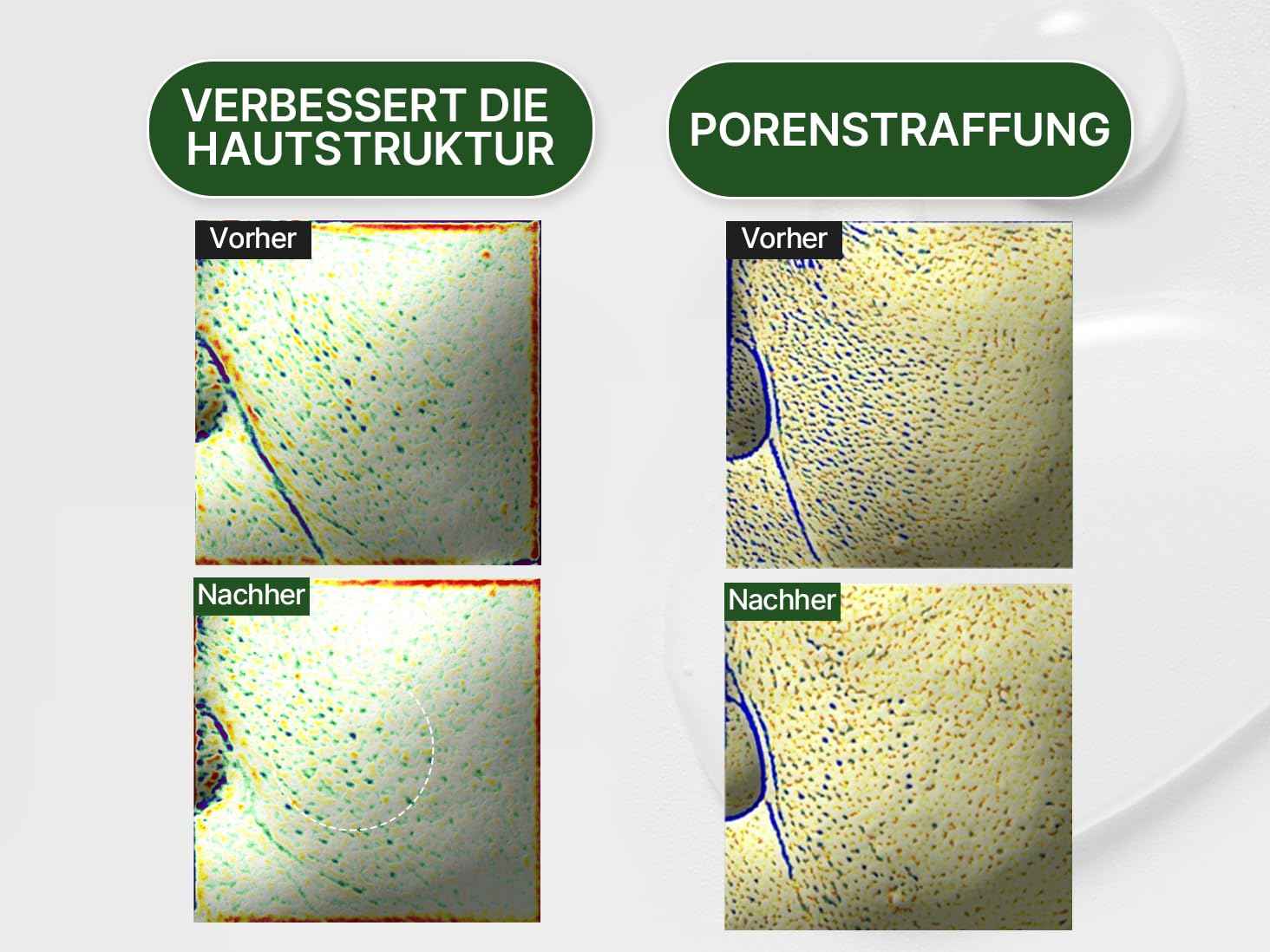 HAMEL Glow 12GF Hyal Essence Toner, Cooling & Moisturizing Booster, Pore Tightening & Radiant Glow with Peptides & 10,000ppm of Hyaluronic Acid, Unscented, Vegan, Cruelty Free, 6.76 fl.oz.