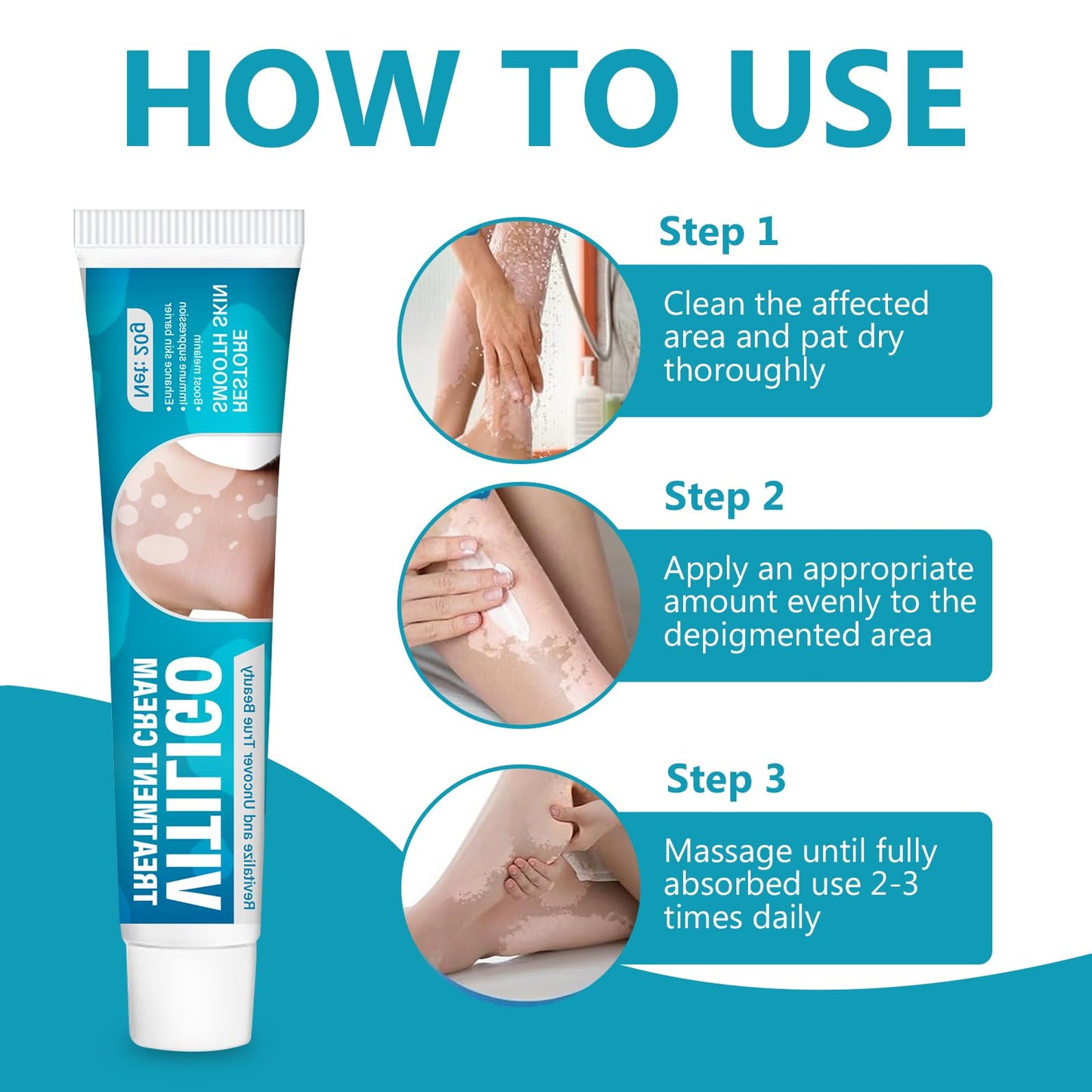 Vitiligo Cream| Effective Treatment of Skin Vitiligo, Reduce Uneven Skin Tone, White Spots, Promote Melanin Production of the Active Ingredients, Suitable for Both Men and Women, 20G