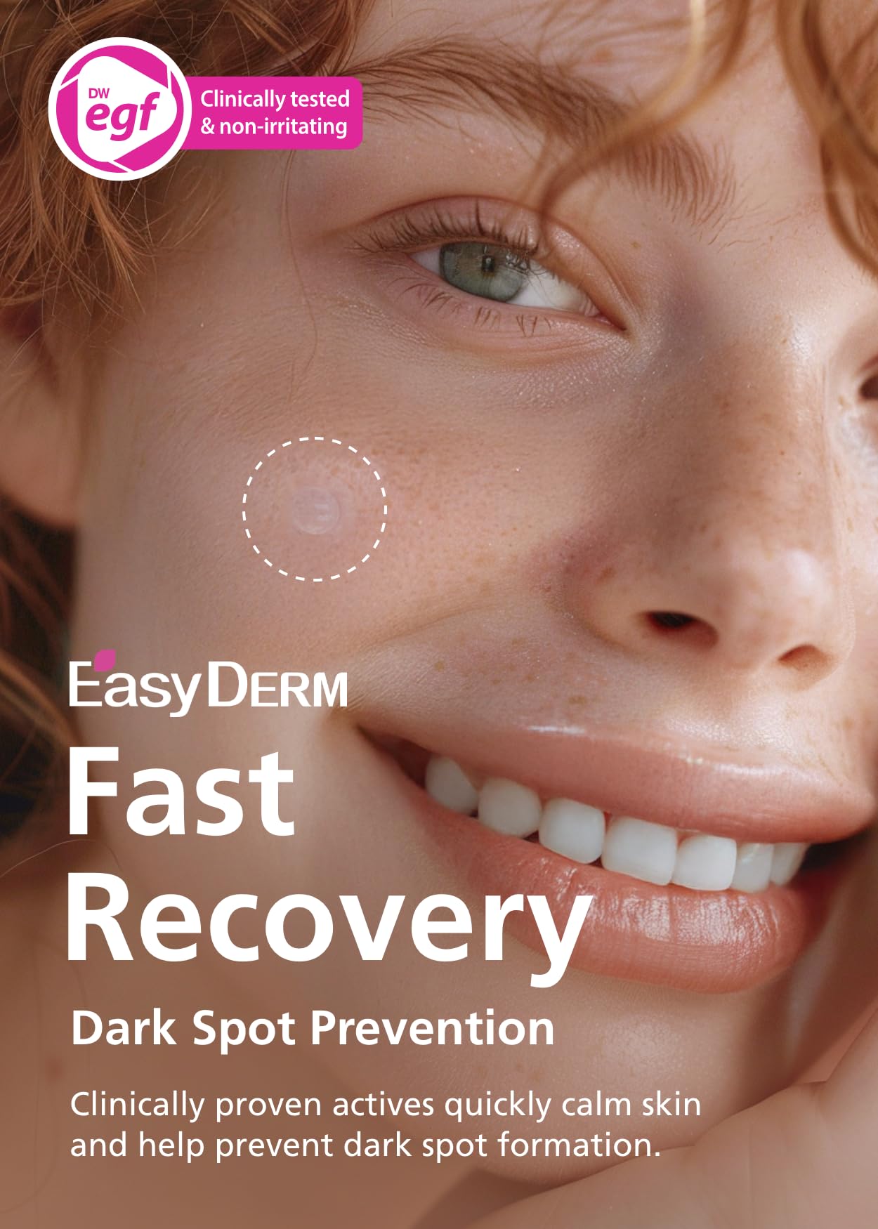 Easyderm Real Calming Patch Pimple Patches, Niacinamide, Hyaluronic Acid, EGF, K-Beauty Skincare | 6 Patches per Pack, 4 Packs (24 Total) Micro Point length : 285μm Summer & Travel Essentials