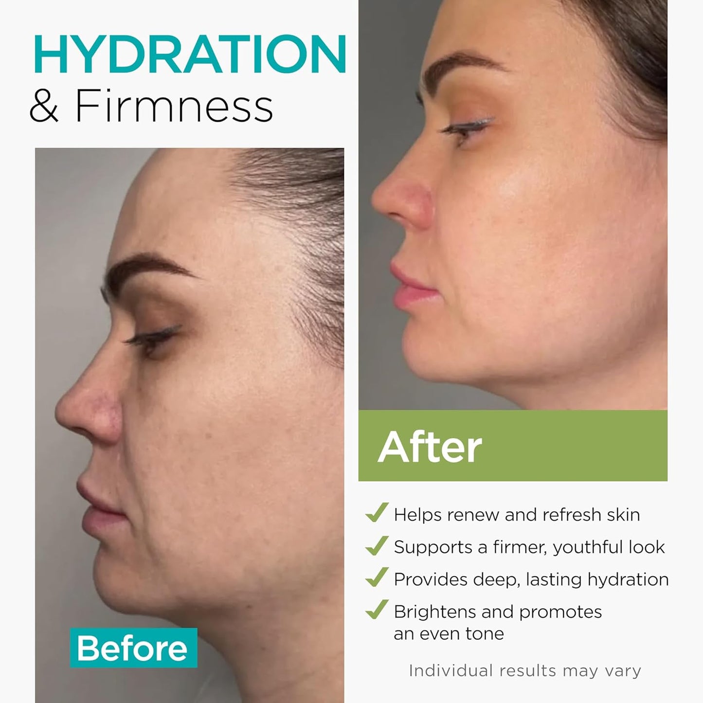 Collagen NAD+ Face Cream - Anti-Aging Moisturizer with Retinol & Hyaluronic Acid | 1.7 Oz, All Skin Types