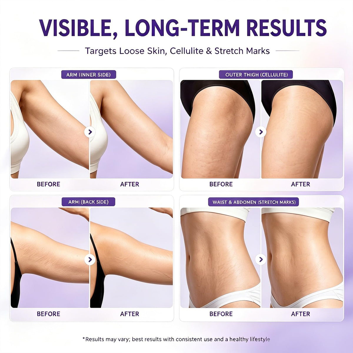AMRAM Overnight Toning Whip, Skin Tightening, Body Firming Whip That Works While You Sleep, Firming Cream For Loose Skin On The Body(3.38 Fl.Oz)