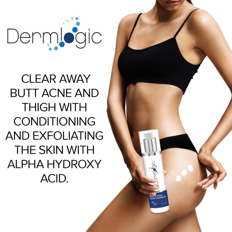 Butt & Thigh Acne Treatment - Fights Acne, Pimples, Zits, Blackheads and Ingrown Hairs for the Buttocks and Thigh Area. Fades Away Dark Spots, Acne marks. Prevents Future Breakouts. 6.09 oz