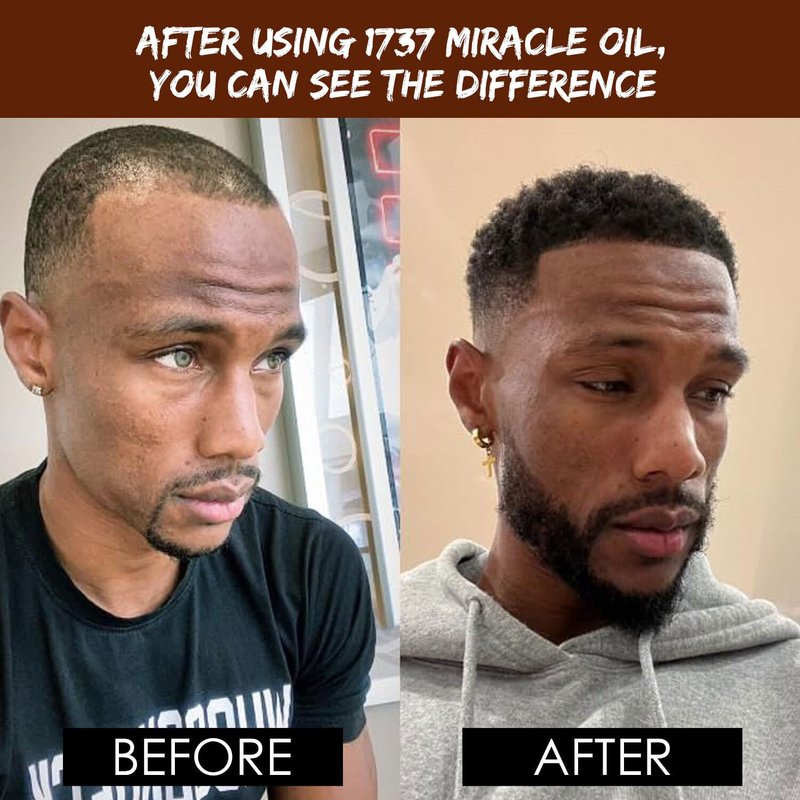 Dixon's 1737 Miracle Oil, Natural Organic Beard, Scalp, Hair Oil for Softening, Shine, Breakage Reduction, Scalp Hydration Organic Nourishment (2 fl Oz)