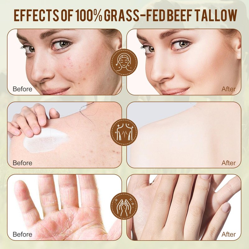 Tallow Face Moisturizer(4.2 oz) - 100% Grass - Fed Beef Tallow Blended with Organic Beeswax and Honey Balm - Tallow and Honey Balm - Deep Wrinkle-Fighting Moisturize,Suitable for All Skin Types