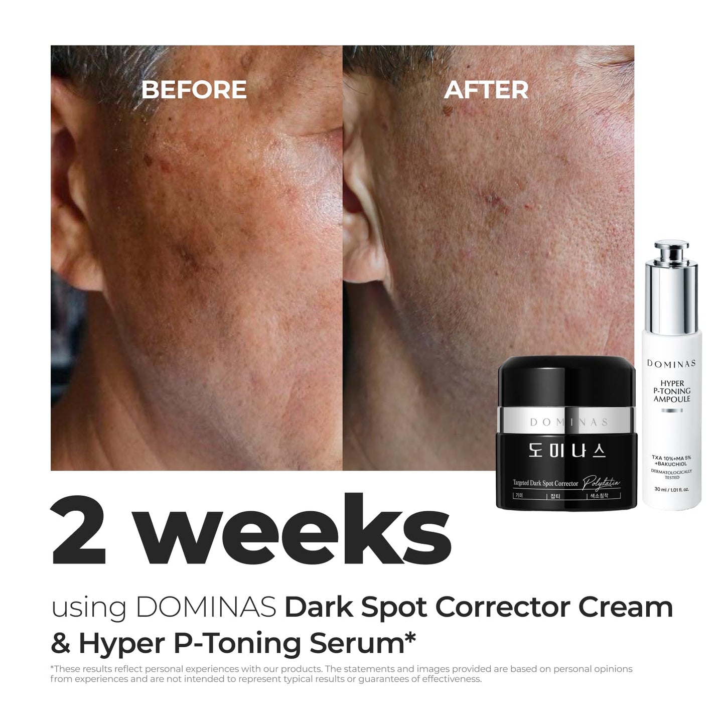 DOMINAS Tranexamic Acid Dark Spot Corrector Cream - Visibly Reduce Age Spots, Sun Spots with TXA, Niacinamide, Bakuchiol, Daily Moisturizer for Uneven Tone & After Spot Care, Korean Skincare, 1.76 oz