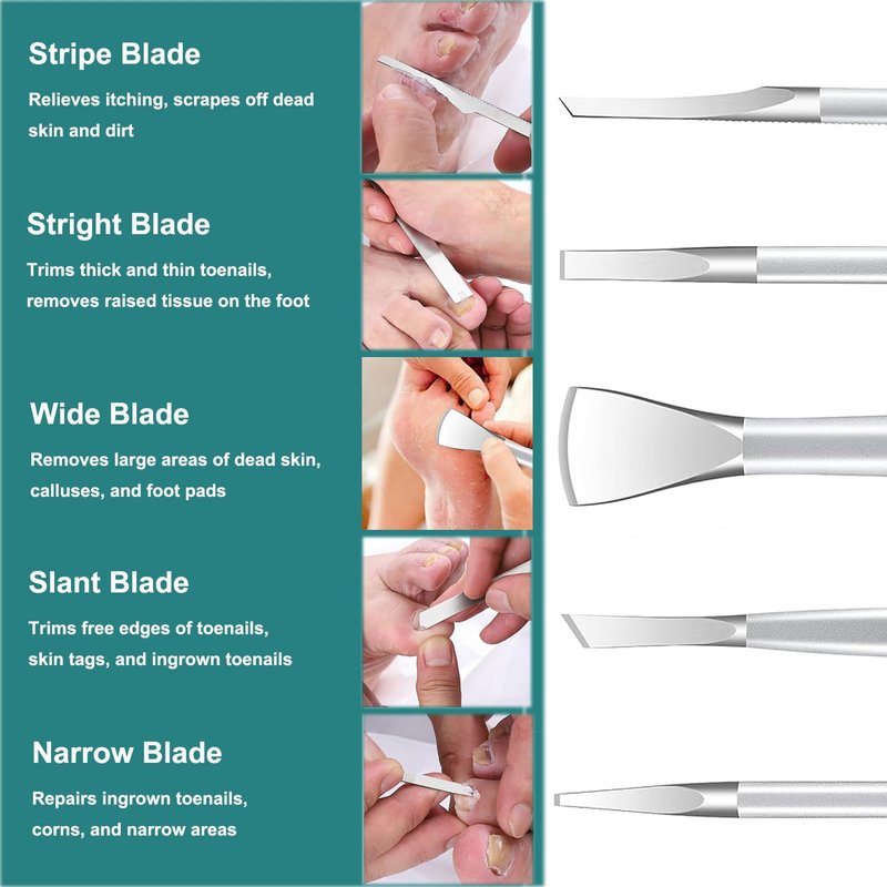 Pedicure Knife Ingrown Toenail Kit, 5 PCS Professional Pedicure Tool Kit, Top Notch Foot Blade Stainless Steel Ingrown Toenail Tool Foot Care Tools Nail Cuticle Remover (5 Pcs Set)