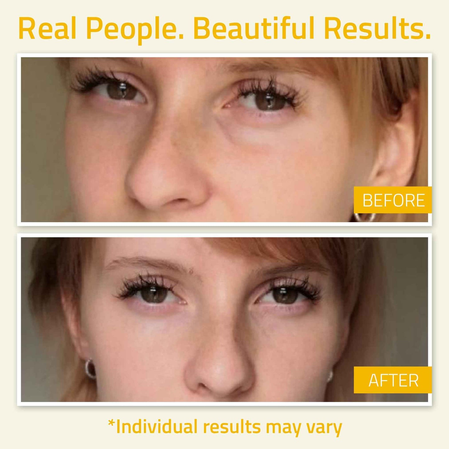 YEOUTH Under Eye Gel with Hyaluronic Acid, Skin Care Targets The Appearance of Puffiness, Dark Circles & Under Eye Bags, Revitalizing Hydrating Skincare 1oz