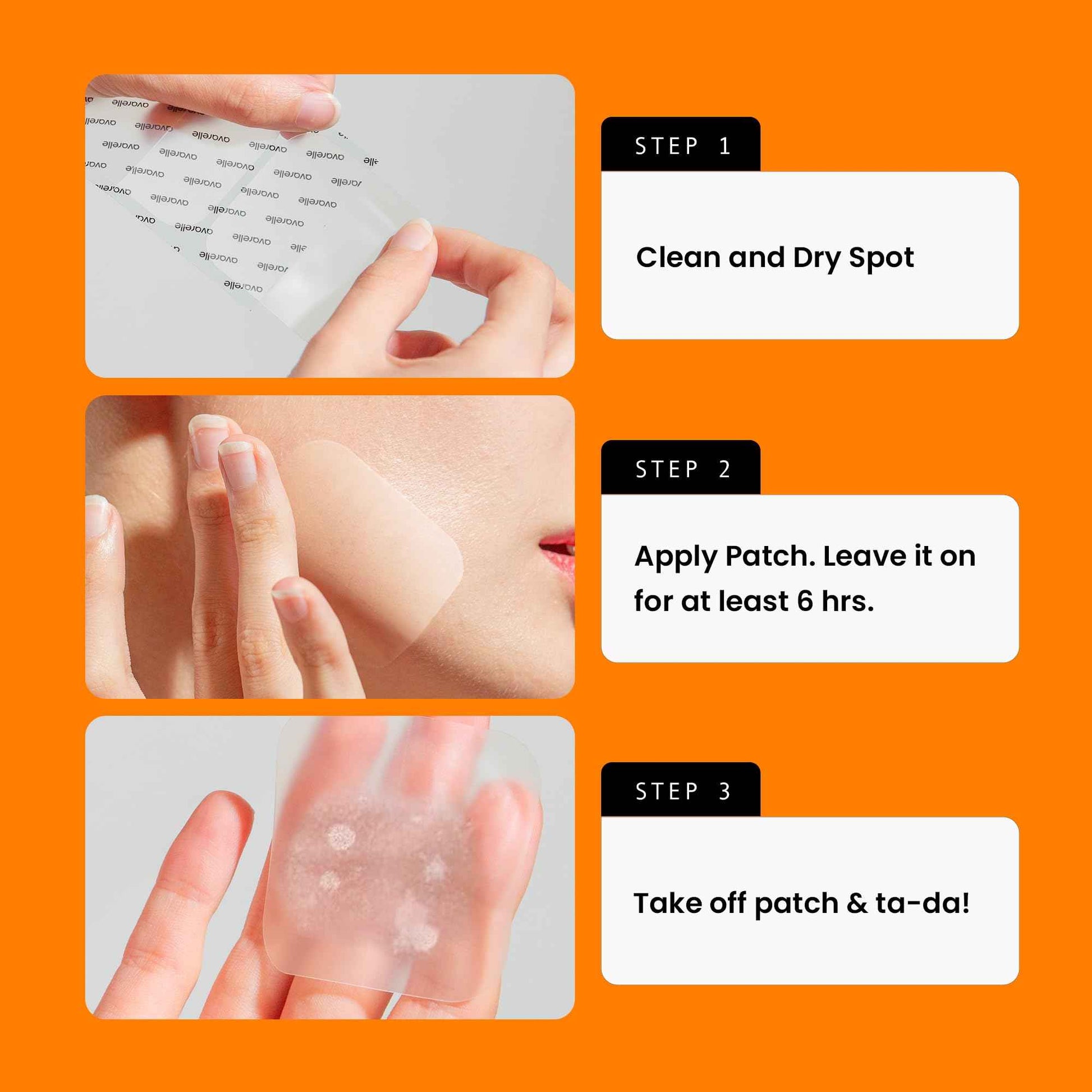 AVARELLE Pimple Patches Full Coverage Combo (Value Pack), Acne Spot Treatment for Blemishes and Zit with Tea Tree Oil, Calendula Oil and Cica Oil for Face, Vegan (80CT Original + XL Patch Bundle)