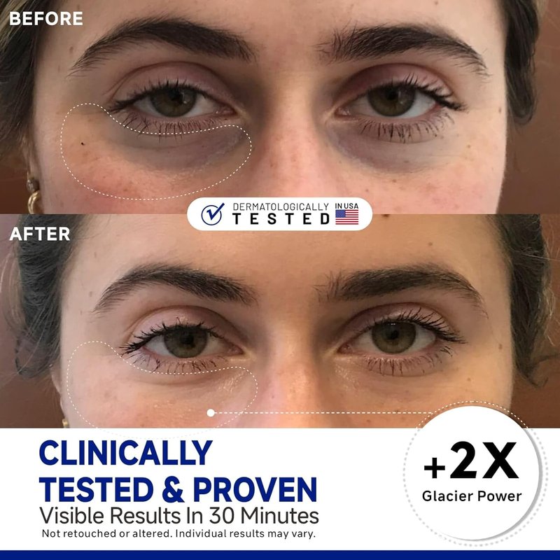 Peptide Cooling Under Eye Patches - Soothing Mask for Dark Circles & Puffiness | 24 Pairs with Glacial Water