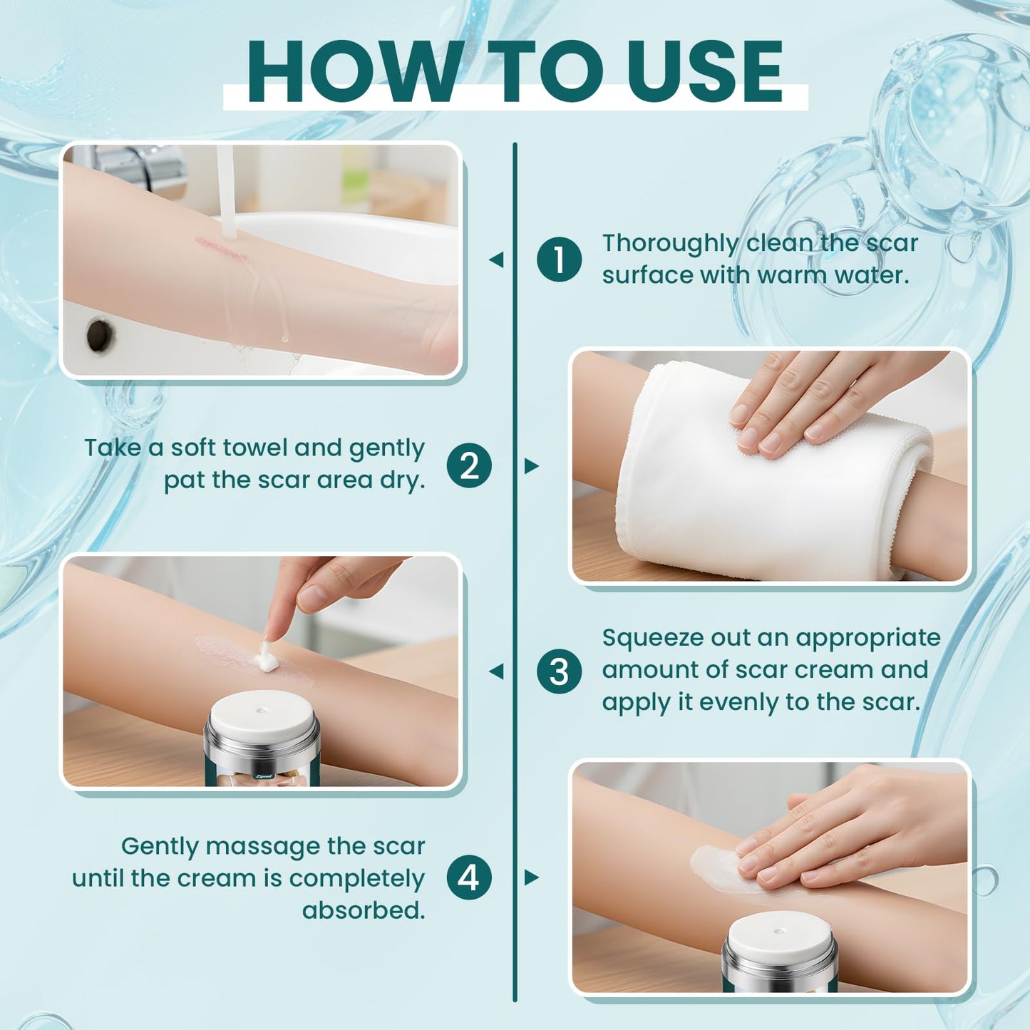 Scar Cream Gel Silicone Removal for Surgical Scars Burn Old Scars Acne Face Stretch Marks Hypertrophic Keloid wait Silicone Gel For Scars Topical Remover 2Pack 1.7 Oz