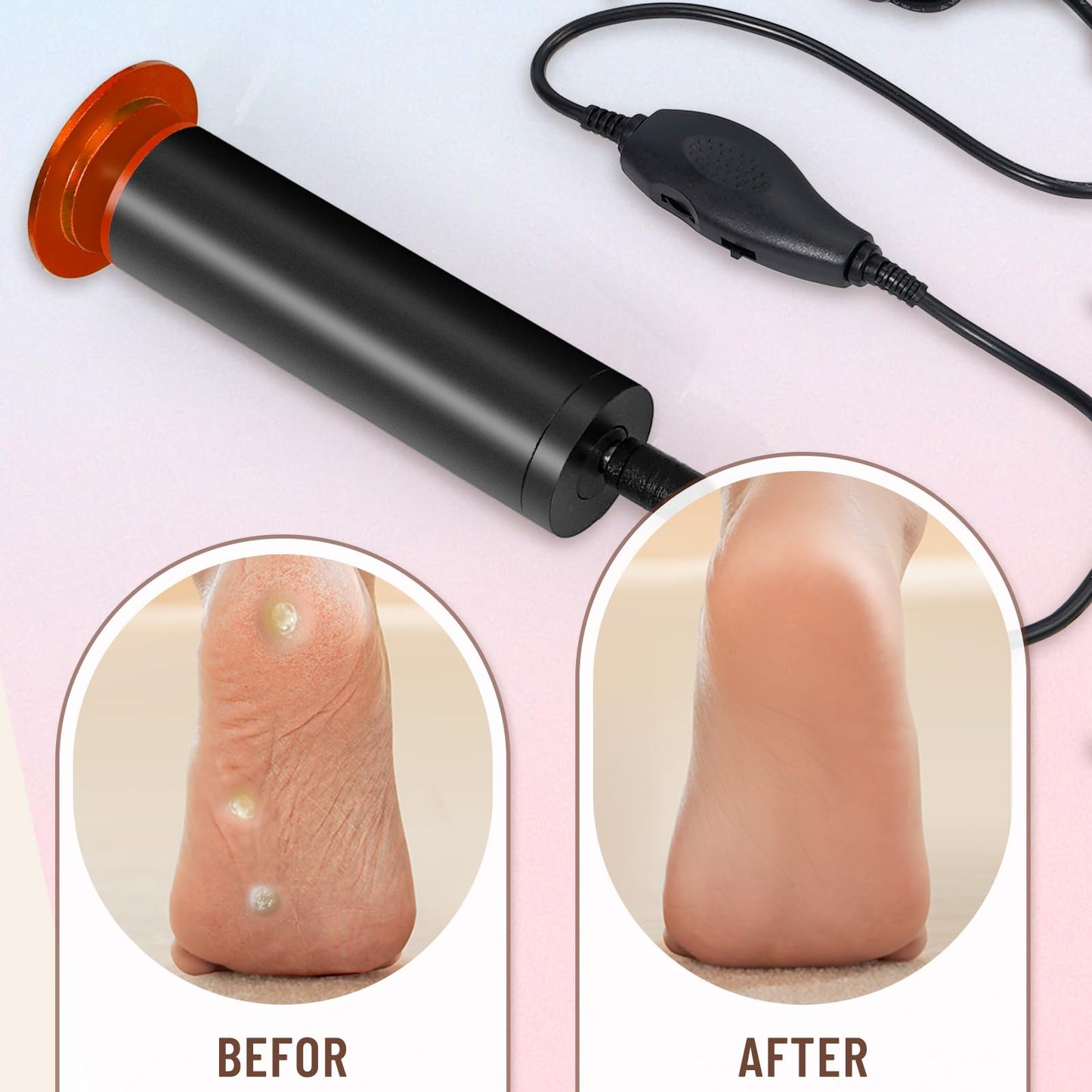 Dermawave Electric Foot File Callus Remover for Feet, Professional Electric Foot Sander Filer Grinder with 60 Sandpaper Discs for Men & Women, Pedicure Tool for Corn Dead Skin Cracked Heel