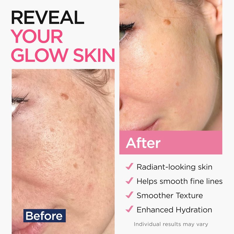 Ember Cloud Retinol Serum for Face (8Oz) with Hyaluronic Acid, Vitamin E & Aloe Vera - Anti-Aging Serum