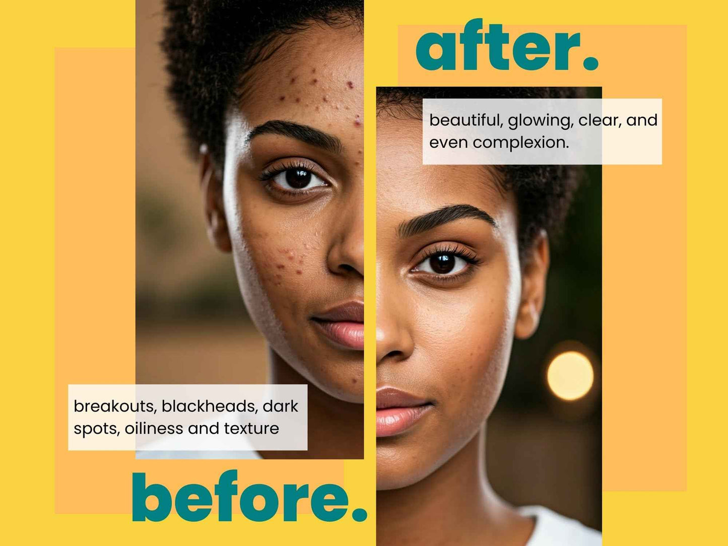 Joli Noir Turmeric Cleansing Soap Bar In A Jar