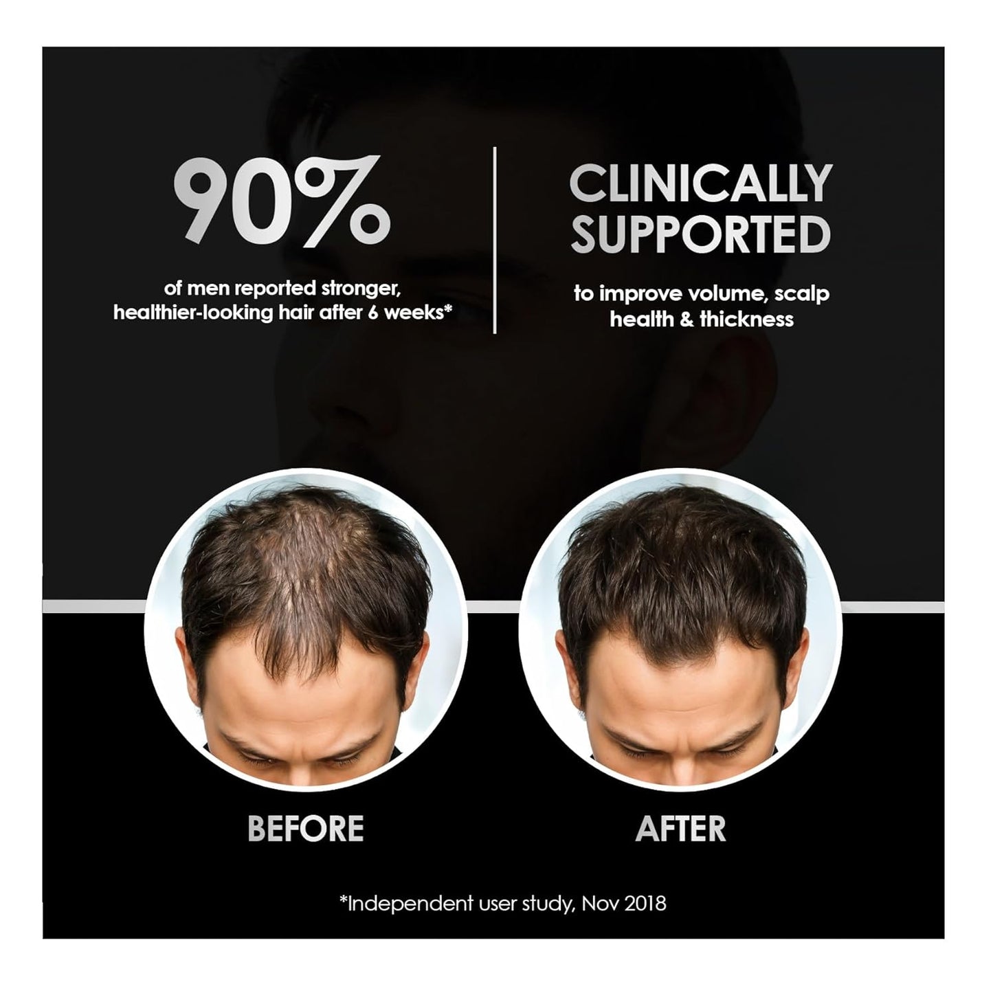 Men's Hair Growth Shampoo & Conditioner Set - Caffeine, Biotin & Saw Palmetto | Sulfate-Free, Vegan, 2-Piece System