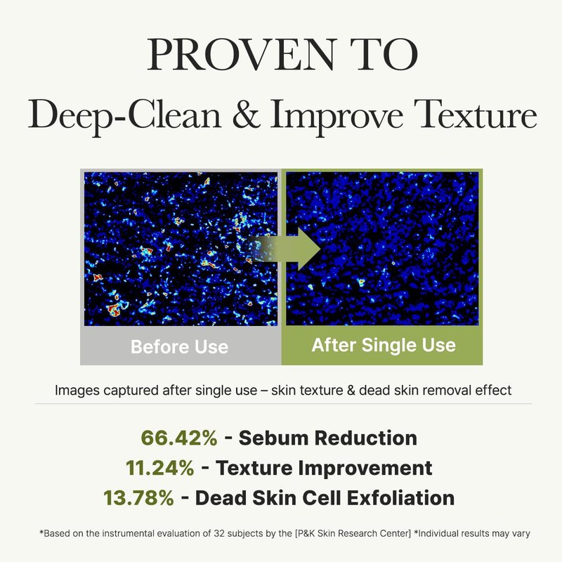 Salicylic Acid Cleanser - Deep Pore Acne Face Wash with Green Tea & LHA | 5.07 fl oz