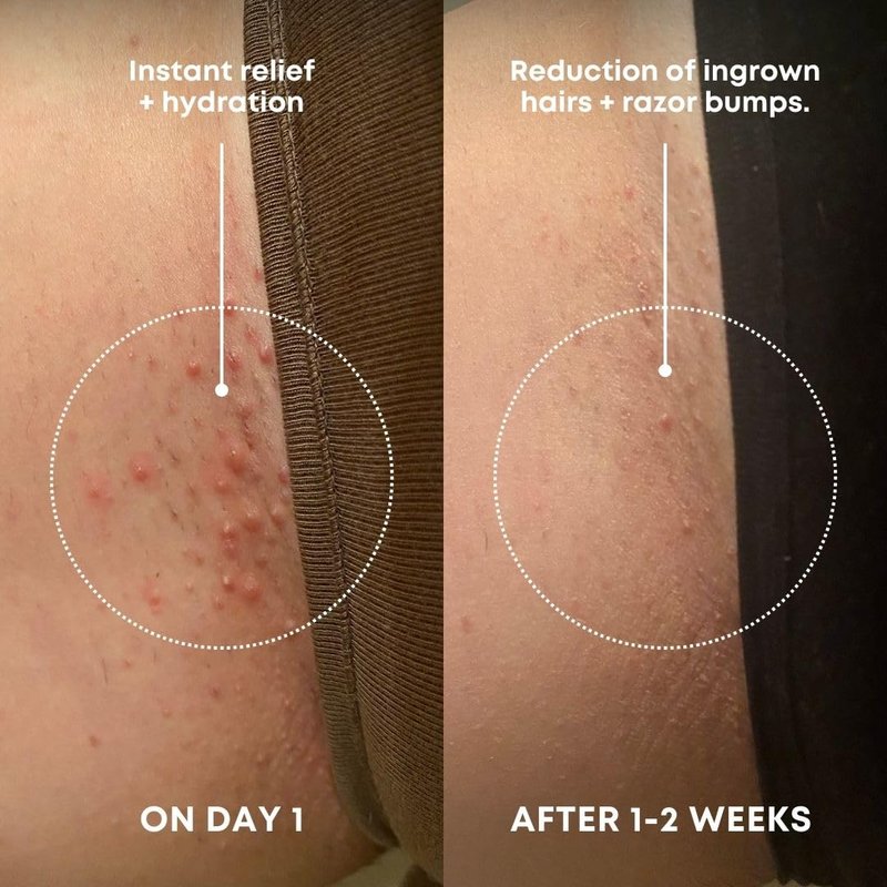 Bushbalm Ingrown Hair Exfoliating Scrub – Pre-Shave Sugar Scrub for Ingrown Hairs, Razor Bumps & Dry Skin – Gently Buffs & Soothes Sensitive Skin - Watermelon Sugar 236ml