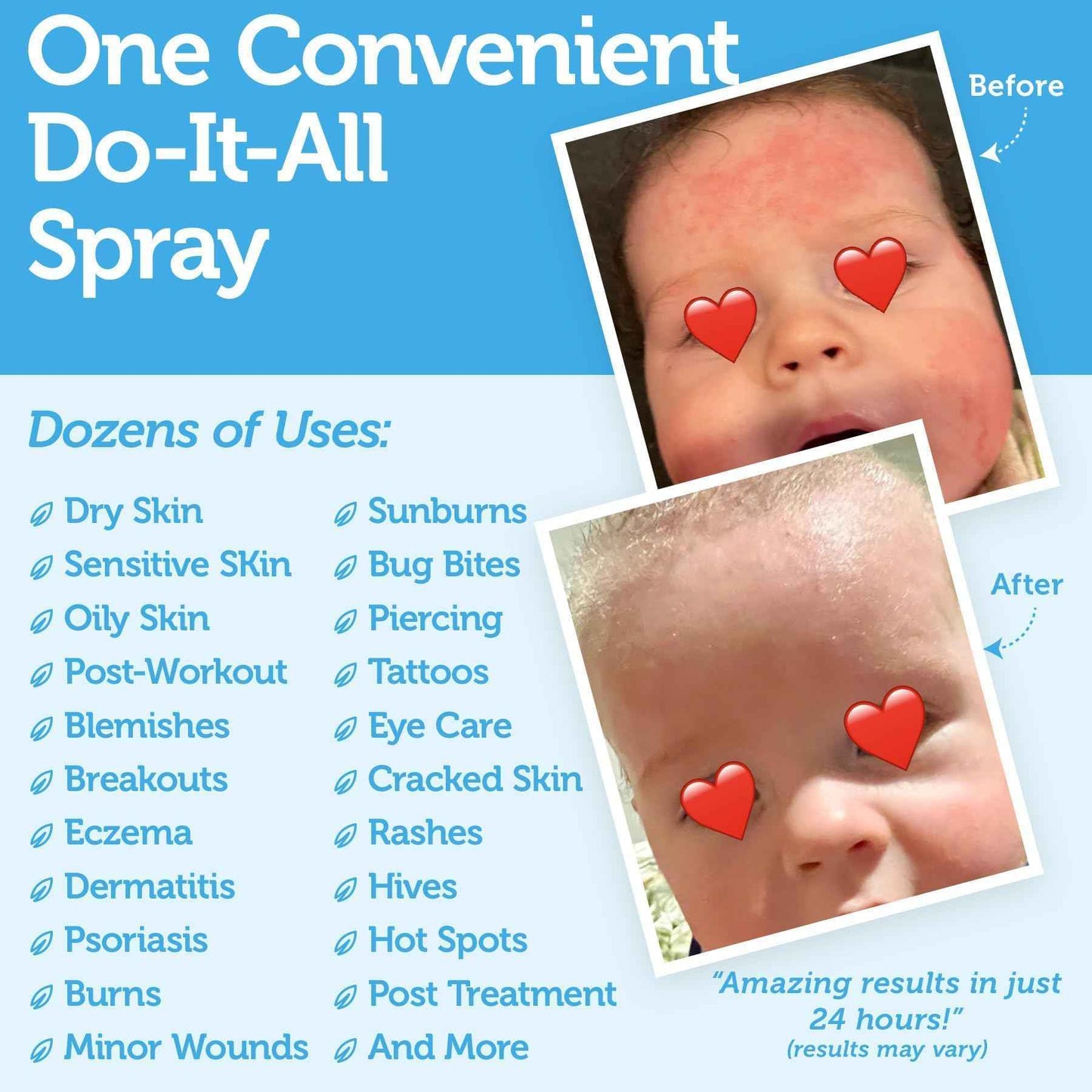 Happy Skin .02% Hypochlorous Acid Spray Toner– Extra Strength, Extra Gentle 100% Natural Toner & Skin Cleanser for Face & Body– Soothe, Hydrate & Repair Dry, Sensitive Skin– pH Balanced, Non-Toxic 8oz