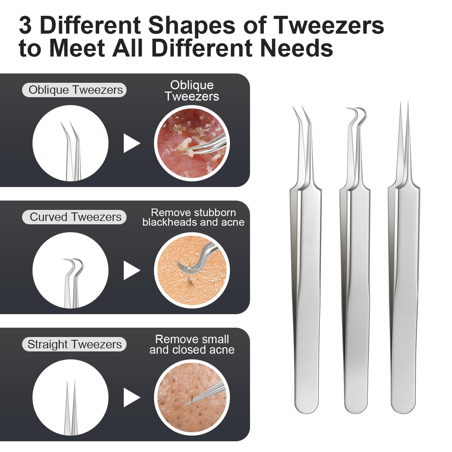 12PCS Professional Salon Grade Blackhead Remover Tool Kit, Comedone Extractor Set for Facial Acne Pimple Blemish Whitehead, Comes with 10X Magnifying Mirror & 20 Alcohol Prep Pads