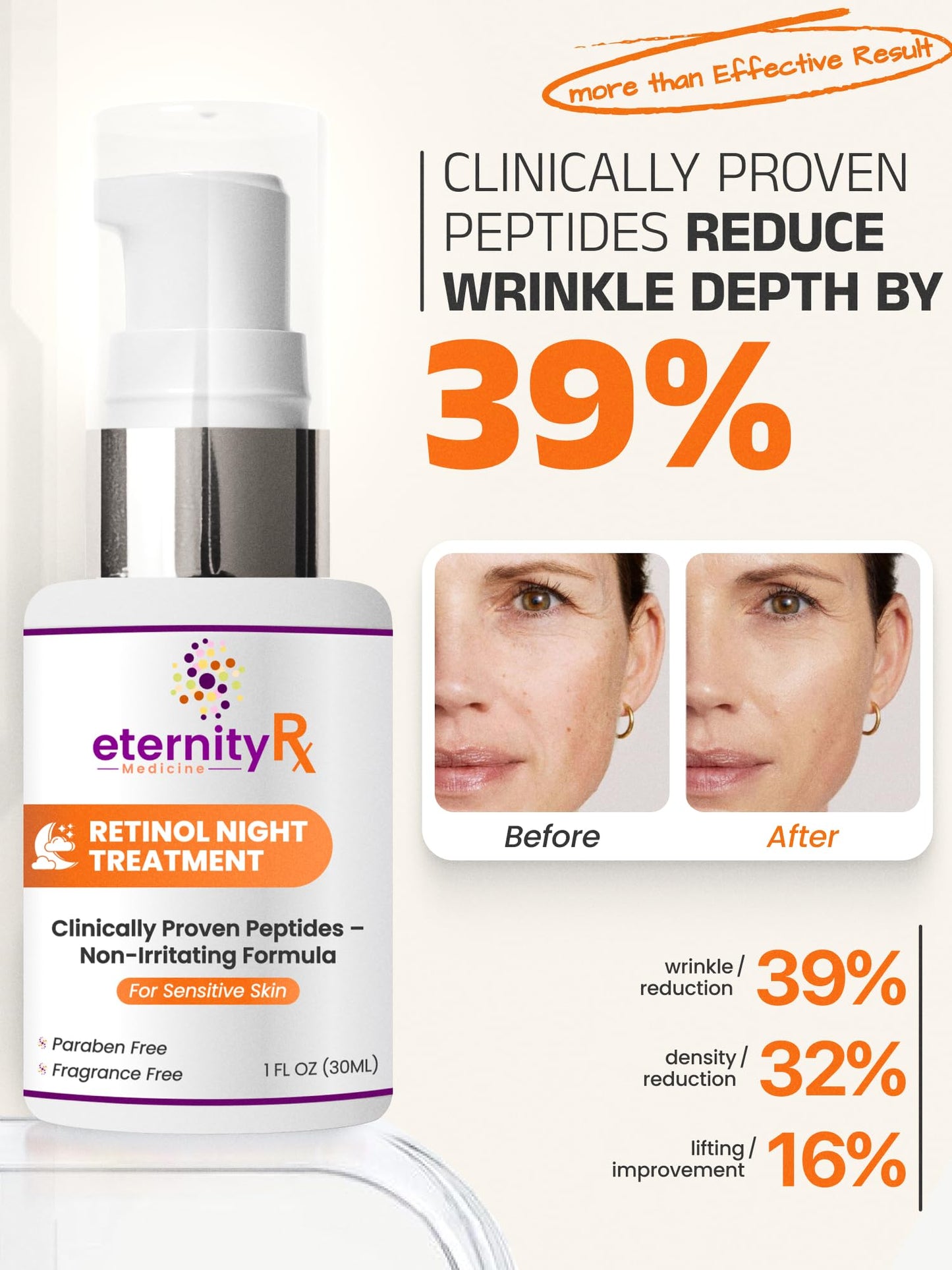 Retinol Night Cream with Vitamin A, Matrixyl 3000, Vitamin C & Daisy Extract – Anti-Aging Night Treatment for Fine Lines, Skin Tone & Wrinkles – Non-Irritating – by Eternity Medicine 1oz
