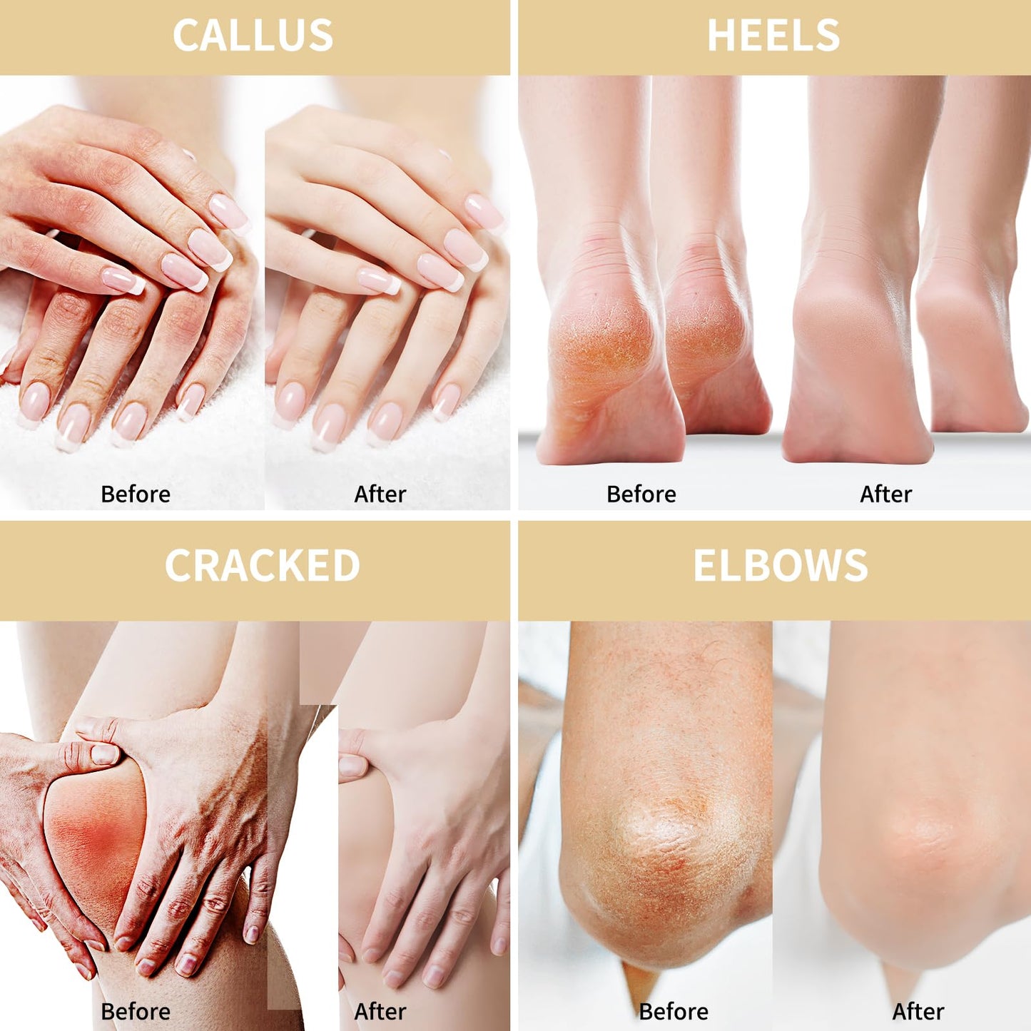 Urea Cream 50 Percent for Feet 10.58 oz with Oat and 2% Salicylic Acid, Foot & Hand Cream included Hyaluronic Acid, Tea Tree and Aloe Vera for Deep Moisturizing, Callus Removing (Upgraded Formula)