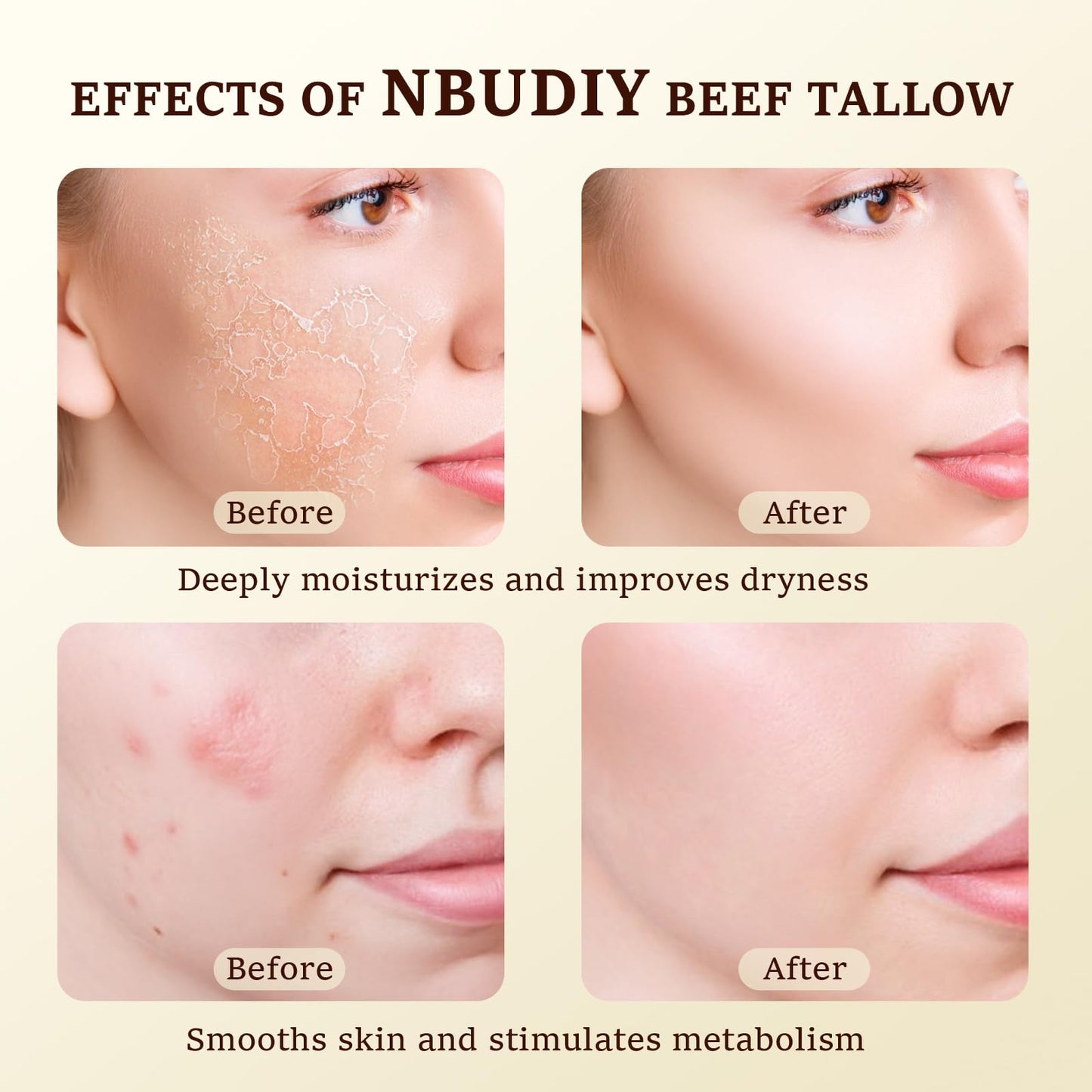 NBUDIY Beef Tallow for Skin, Tallow and Honey Balm, Tallow Face Moisturizer, Grass Fed Beef Tallow for Face - Sensitive Dry Skin Repair, Deeply Nourishing, Fragrance Free, 4.23Oz, Unscented