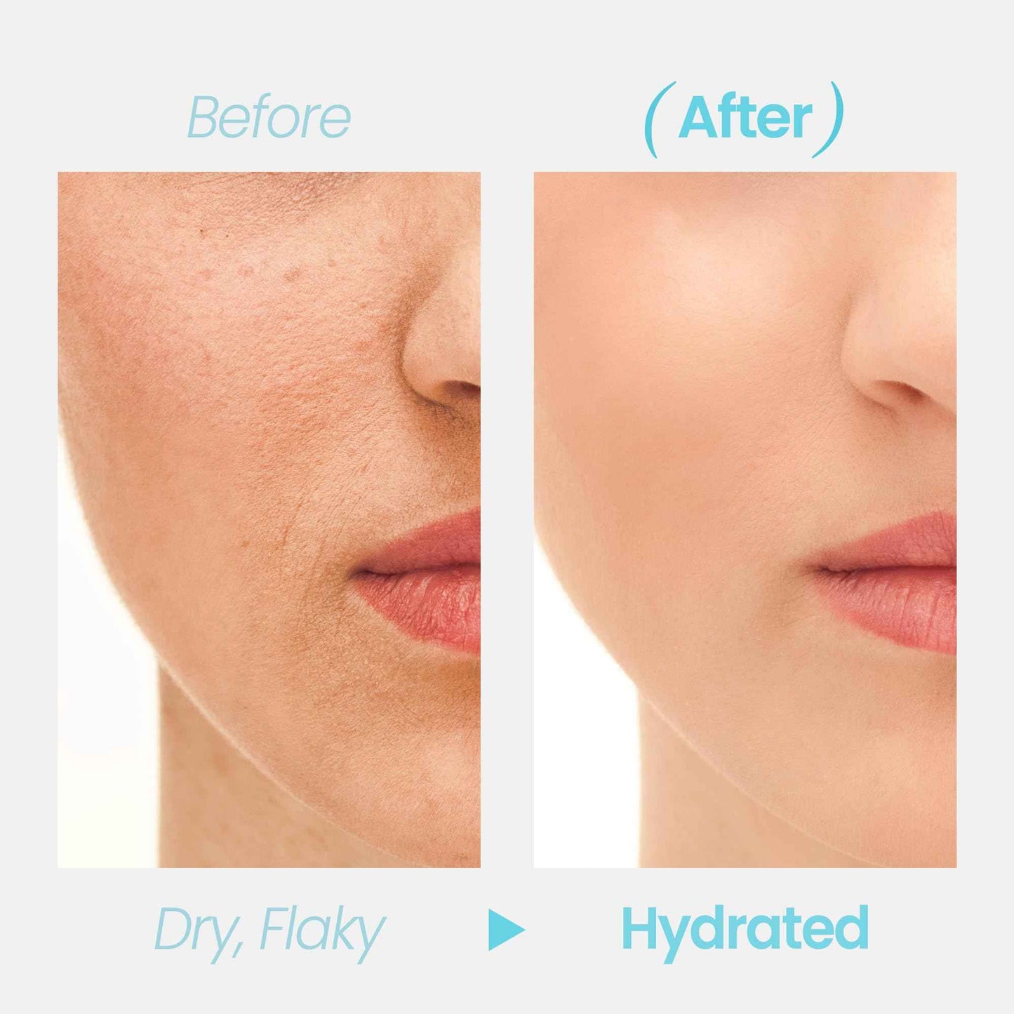 Types Lab Hydration Barrier 96+ Serum | Hydrating Serum w/Beta-Glutan, Panthenol & Ceramides | Skin Barrier Repair Moisturizer K Beauty Serum for All Skin Types (50ml, 1.69 fl oz)