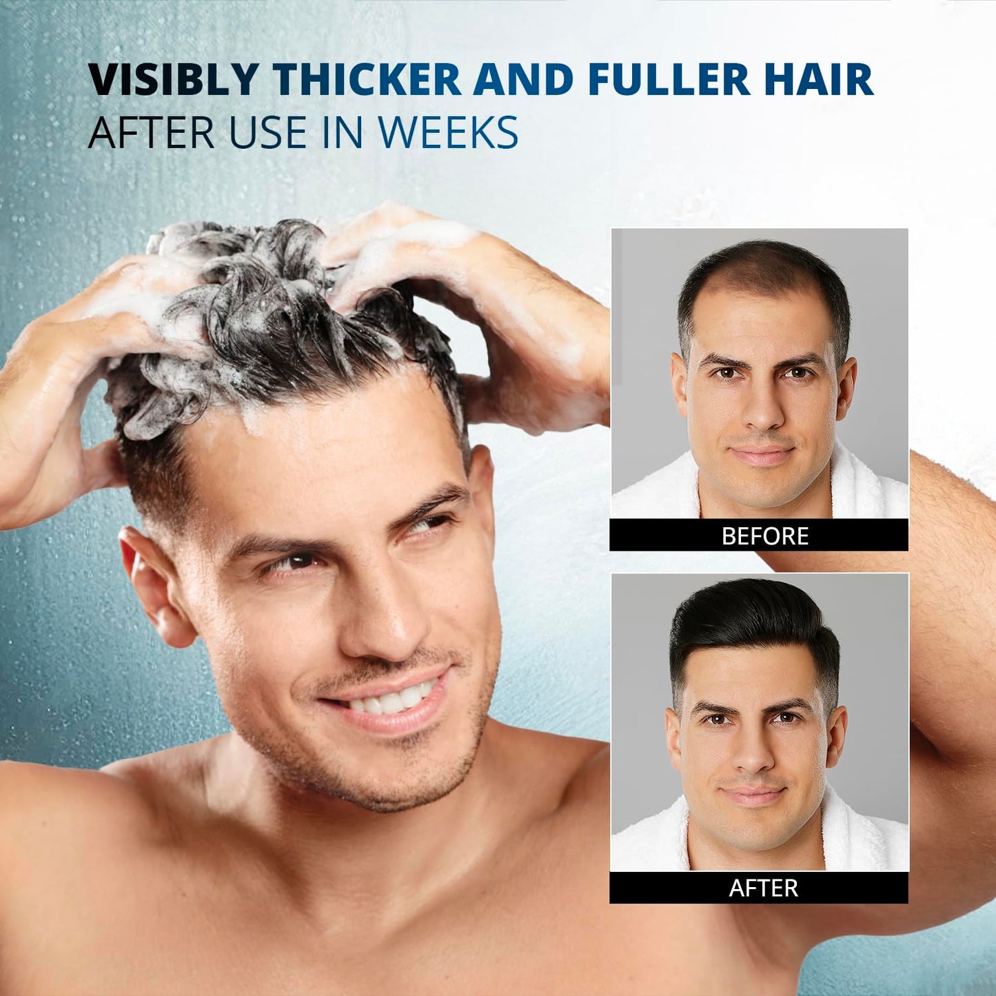 Root Activator Hair Growth Shampoo Conditioner for Men (11.1 Fl Oz (Pack of 1), Root Activator Shampoo)