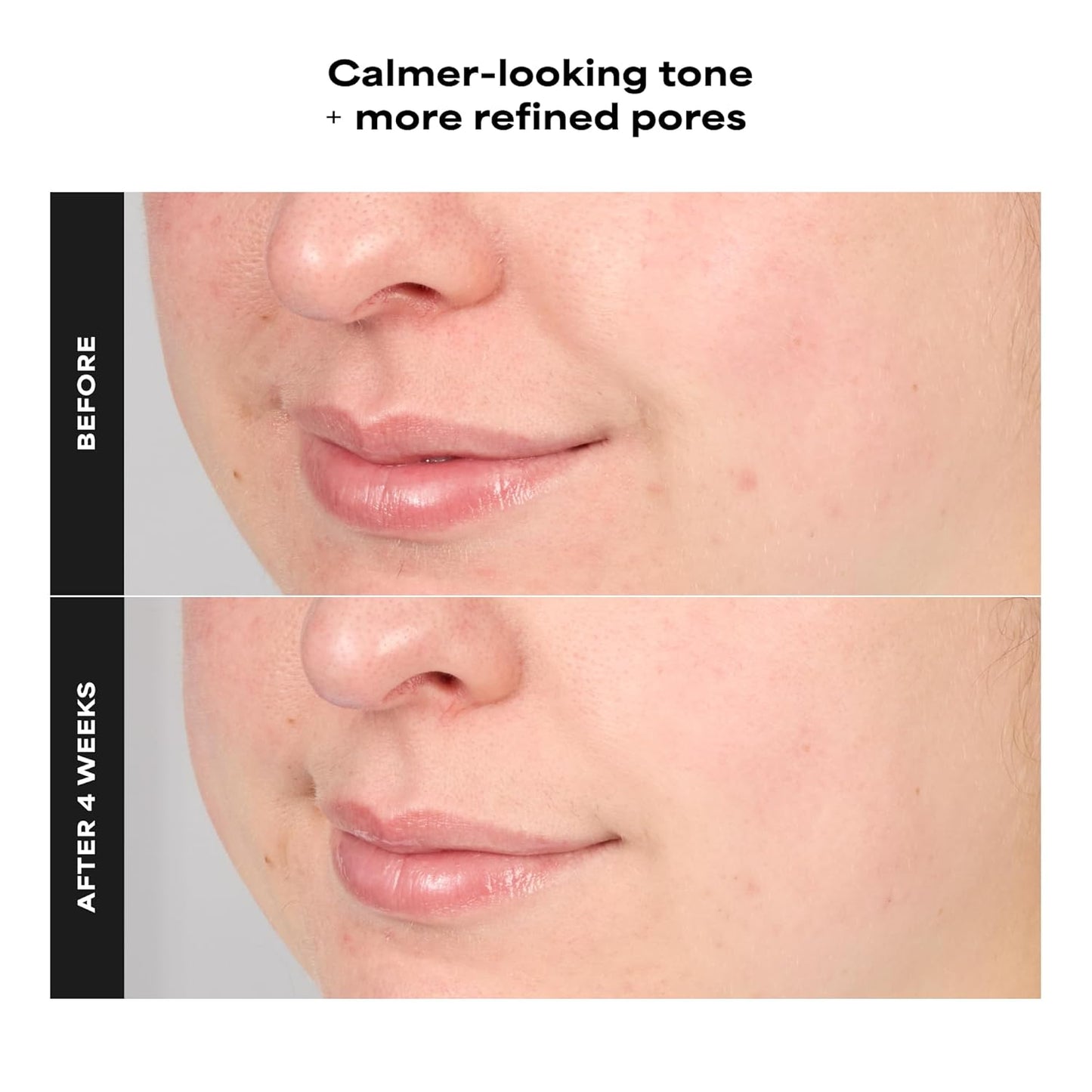 Paula's Choice BHA Serum - Advanced Pore Refining Treatment with Salicylic Acid & Green Tea | 1 Fl Oz, Fragrance-Free for Oily & Combination Skin