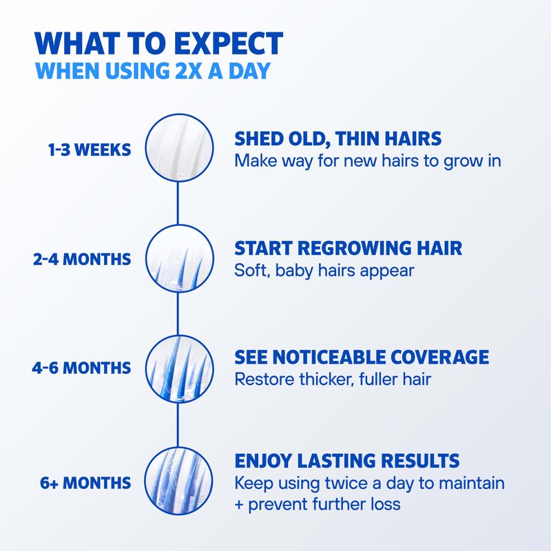 Men's Rogaine Extra Strength 5% Minoxidil Topical Solution for Hair Loss & Regrowth, Topical Treatment for Men, Unscented Minoxidil Follicle Booster Solution, 1-Month Supply, 2 fl. oz