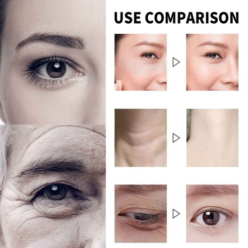 GROHESE Qingling Face Cream, Quinglin Crema Para Arrugas, Qingling Wrinkle Removal Cream, Polypeptide Tightening and Anti-Wrinkle Cream, Facial Neck Eye Cream Anti-Aging for Men & Women (1)