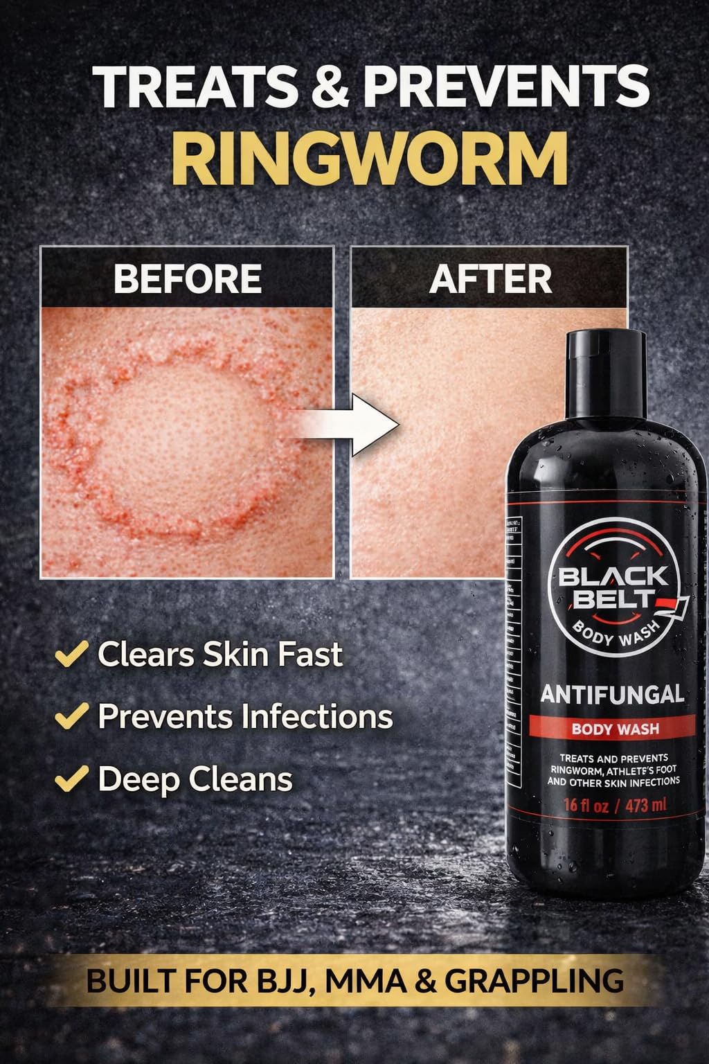 Blackbelt Body Wash - Antifungal Athlete's Body Soap - Prevents and Treats Ringworm, Jock Itch and Athlete's Foot