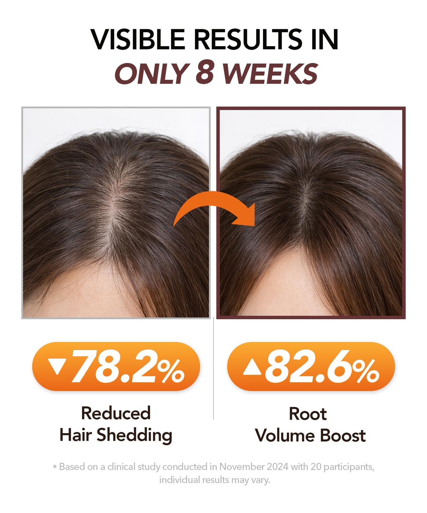 Motifull Hair Boosting Ampoule Tonic | Scalp Serum for Fine & Thinning-Looking Hair | Lightweight TrinogeniX Formula for Women & Men (0.51 fl. oz.)